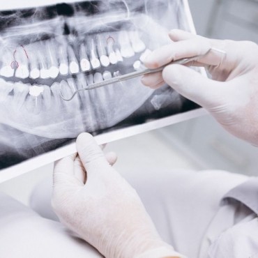 Fraturas Alvéolo-Dentárias em Nova Hartz - RS