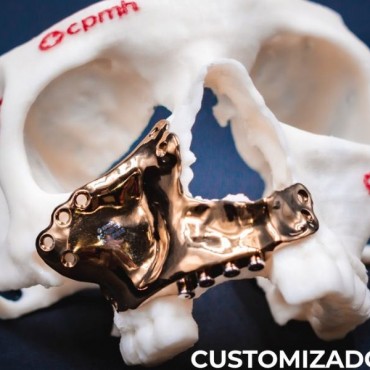 Cirurgias Faciais Complexas em Nova Hartz - RS